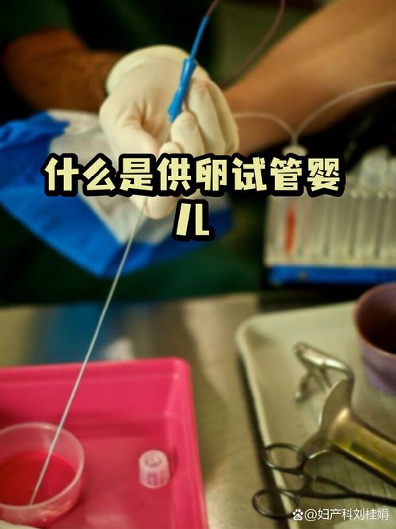 供卵试管婴儿