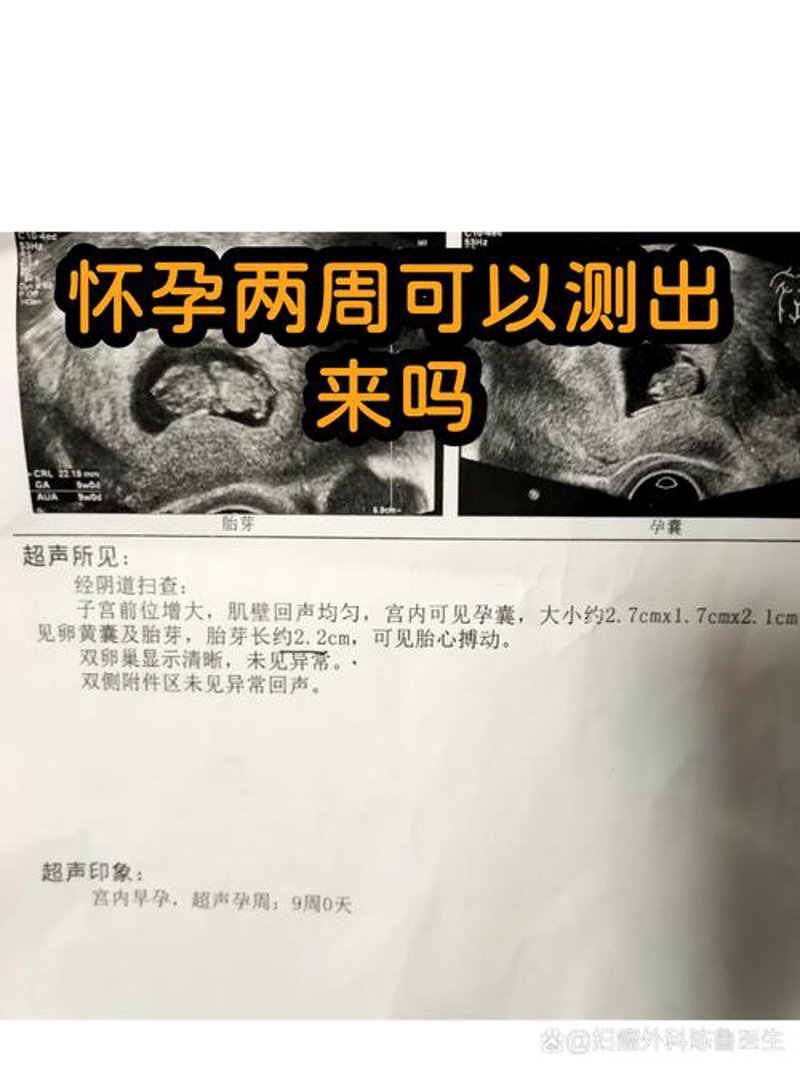 试管婴儿成功率现状与展望