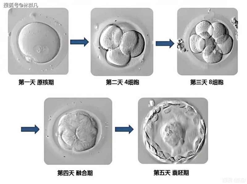 胚胎移植