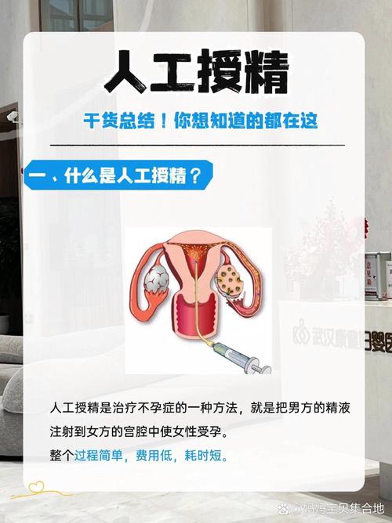 人工授精